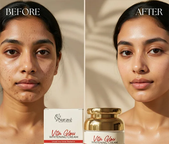 thenurave-Reclaim Your Radiance – Reveal a Brighter B & A